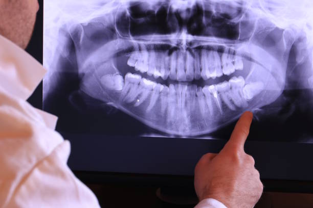 Best Emergency Broken Tooth Repair in Parker, CO